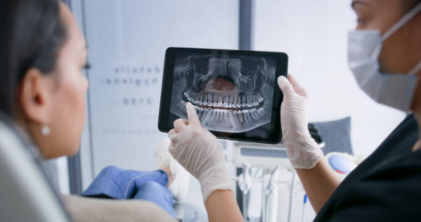 Licensed Wisdom Tooth Removal service in Fayette County County, GA - Smile Center Dentistry